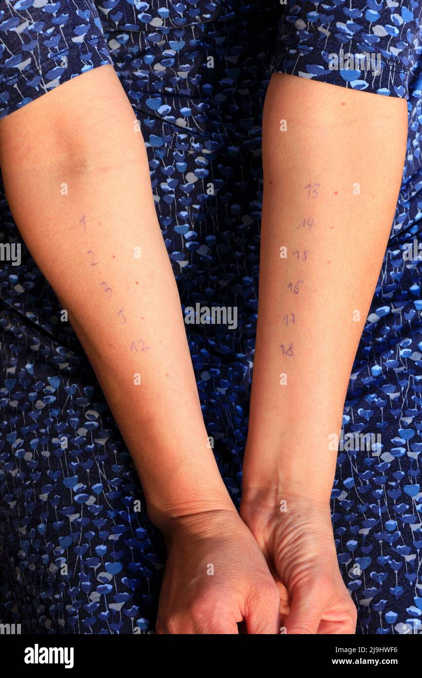 Mani di donna matura con numeri di test allergici Foto Stock