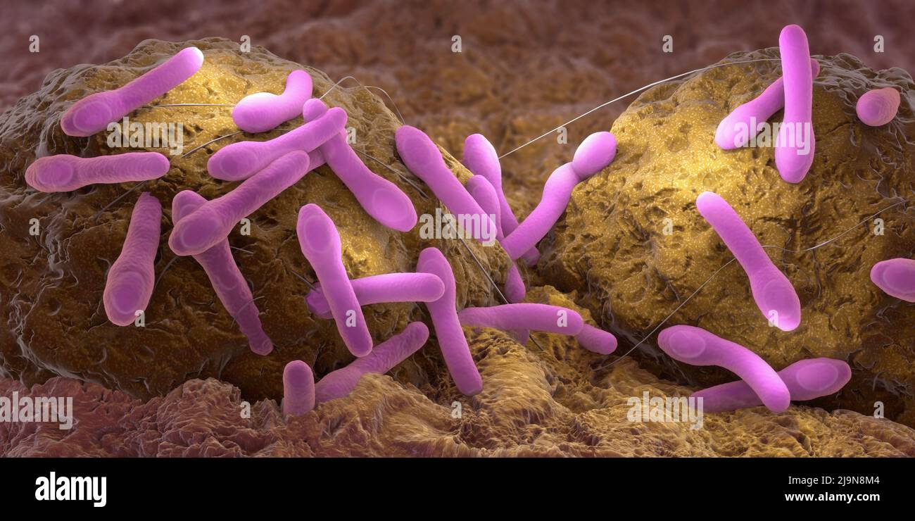 Clostridium botulismo patogeni che crescono su tessuto organico - 3D illustrazione Foto Stock