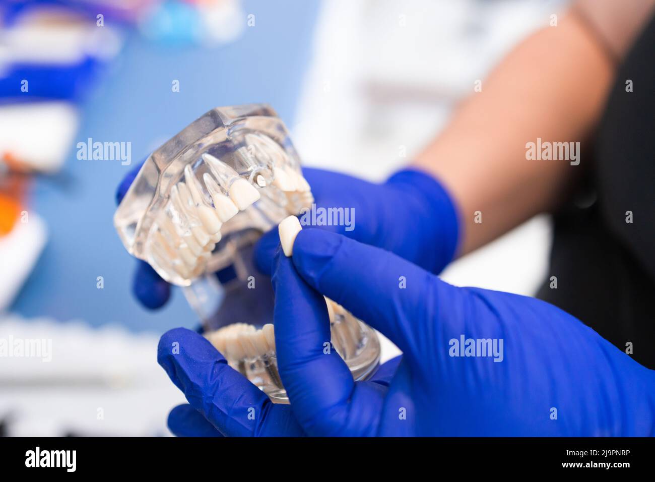 Dentista che tiene una mandibola artificiale inferiore. Protesi dentaria. Piastra dentaria. Lavori di protesi Foto Stock