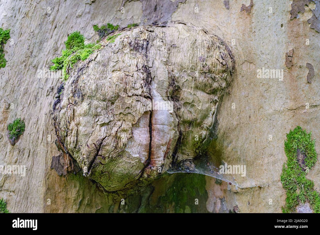 Grande crescita sulla malattia del tronco di albero di abbaio. Tumore sul tronco di albero, con cricca di cricca in mezzo, primo piano, cresciuto con muschio. Malattie di Sycamore Foto Stock