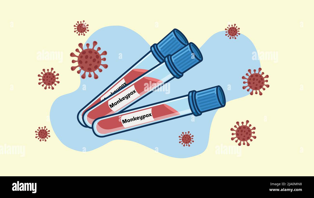 Vettore di provette per analisi del sangue Monkeypox Illustrazione Vettoriale