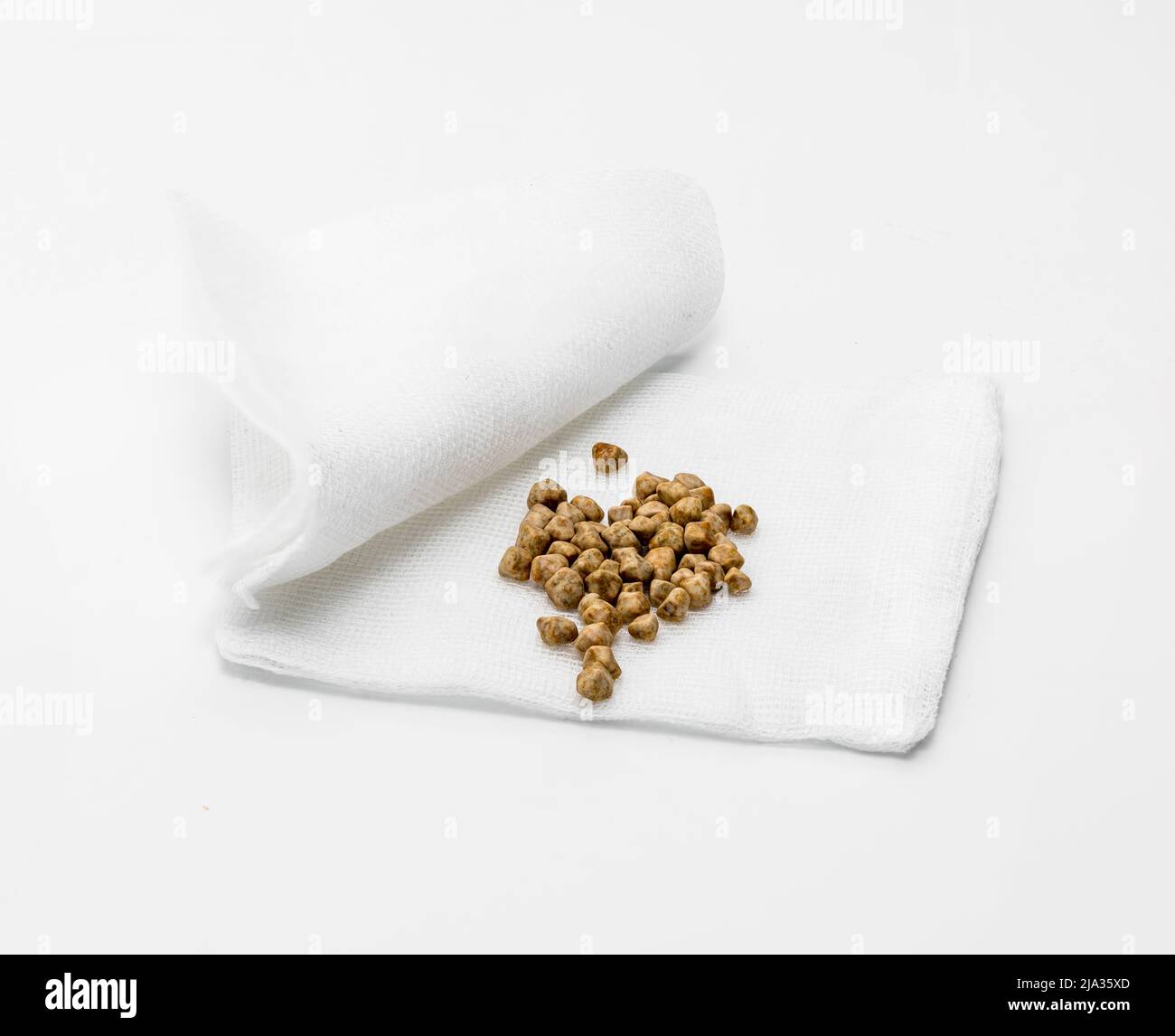 ha rimosso i gallstones che posano sulle bende Foto Stock