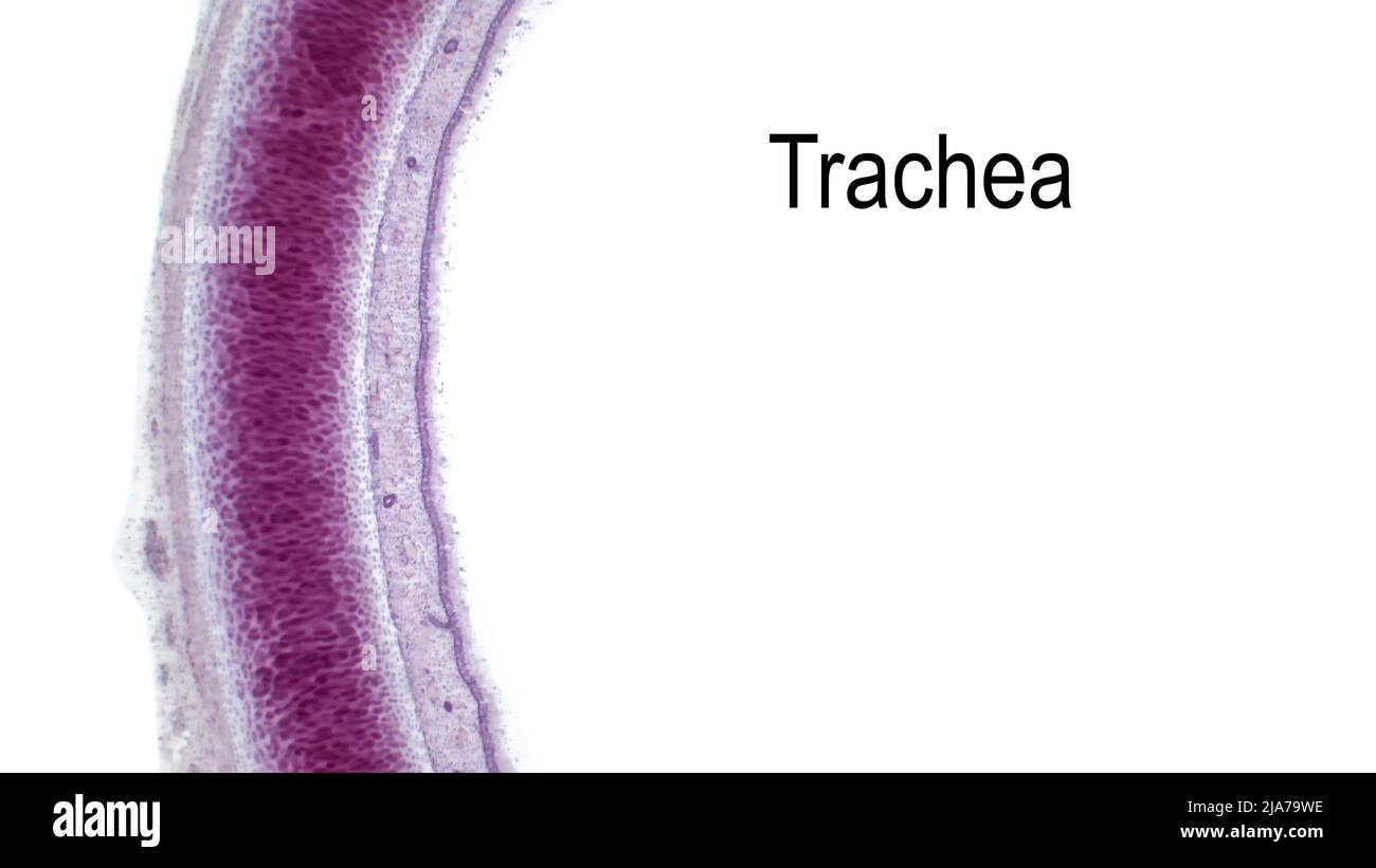 Sistema respiratorio umano. Sezione trasversale della trachea. La mucosa tracheale si trova all'interno della cartilagine. Colorante per eosina fine ematossilina. Foto Stock