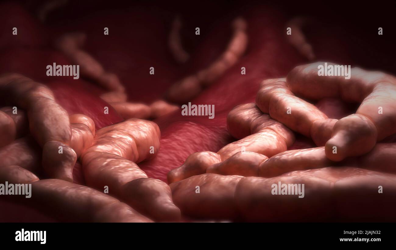 Illustrazione biomedica concettuale dei parassiti di Echinococcus all'interno del fegato. Foto Stock