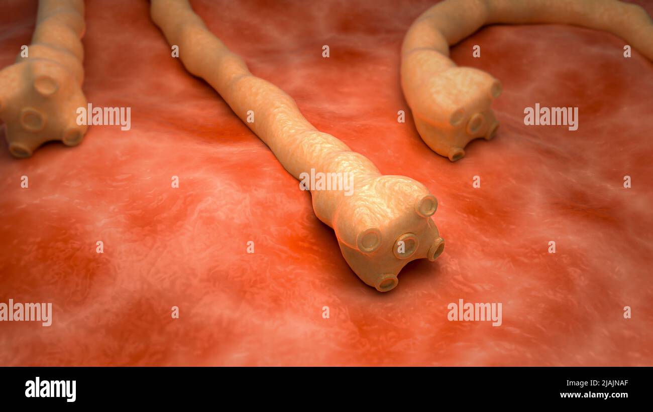 Illustrazione biomedica concettuale dei tapeworms. Foto Stock
