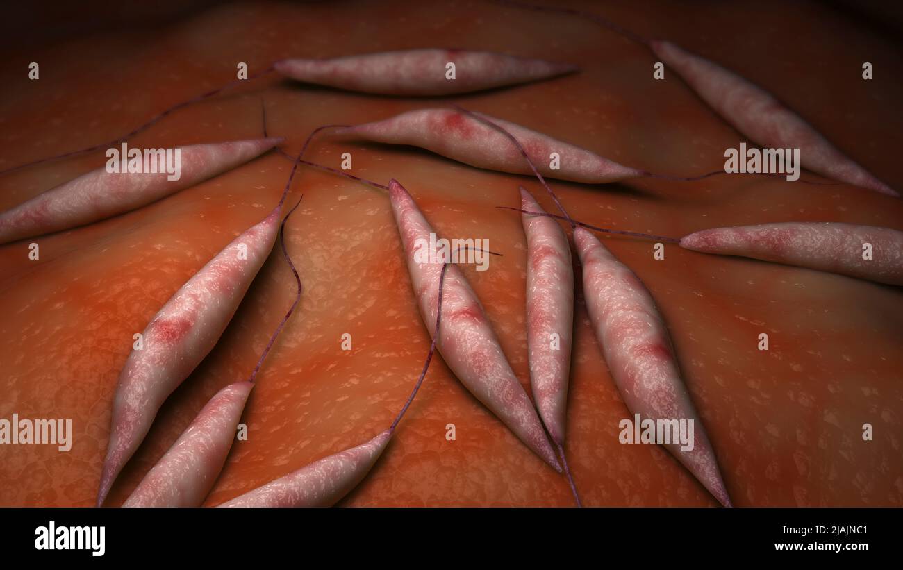 Illustrazione biomedica concettuale della leishmaniosi viscerale, una malattia infettiva. Foto Stock