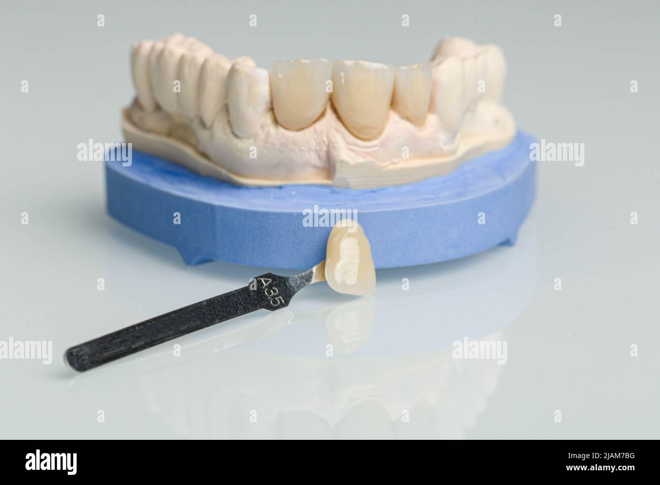 controllo della nuca della protesi dentaria in laboratorio dentistico con una guida per paralume Foto Stock