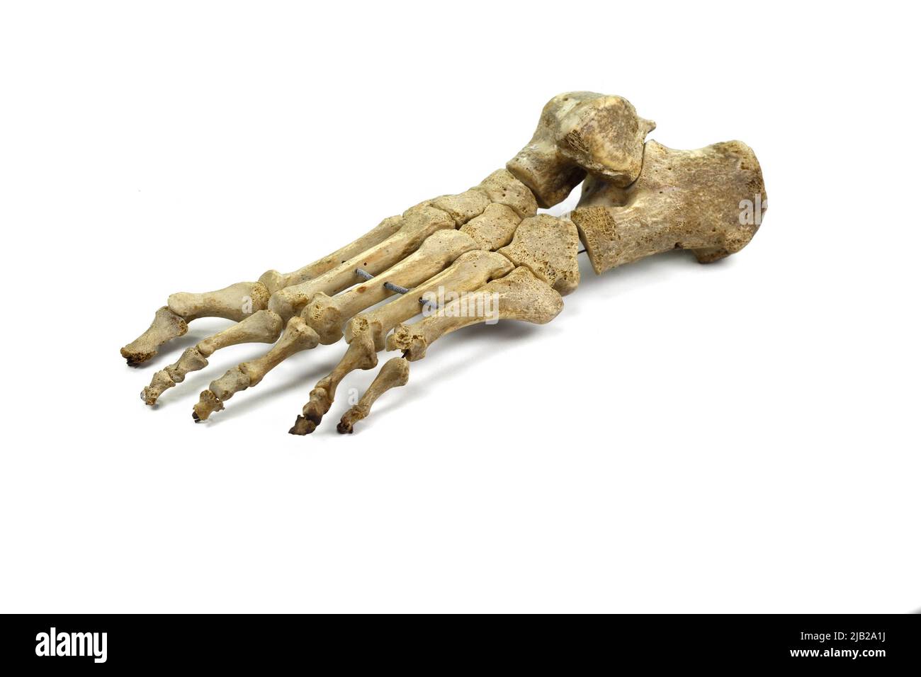 Osso piede sinistro. Osso del piede, osso della caviglia per insegnare gli allievi medici isolato su sfondo bianco. Foto Stock