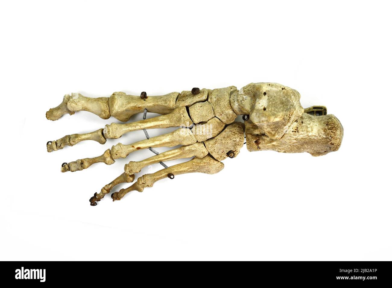 Osso piede sinistro. Osso del piede, osso della caviglia per insegnare gli allievi medici isolato su sfondo bianco. Foto Stock