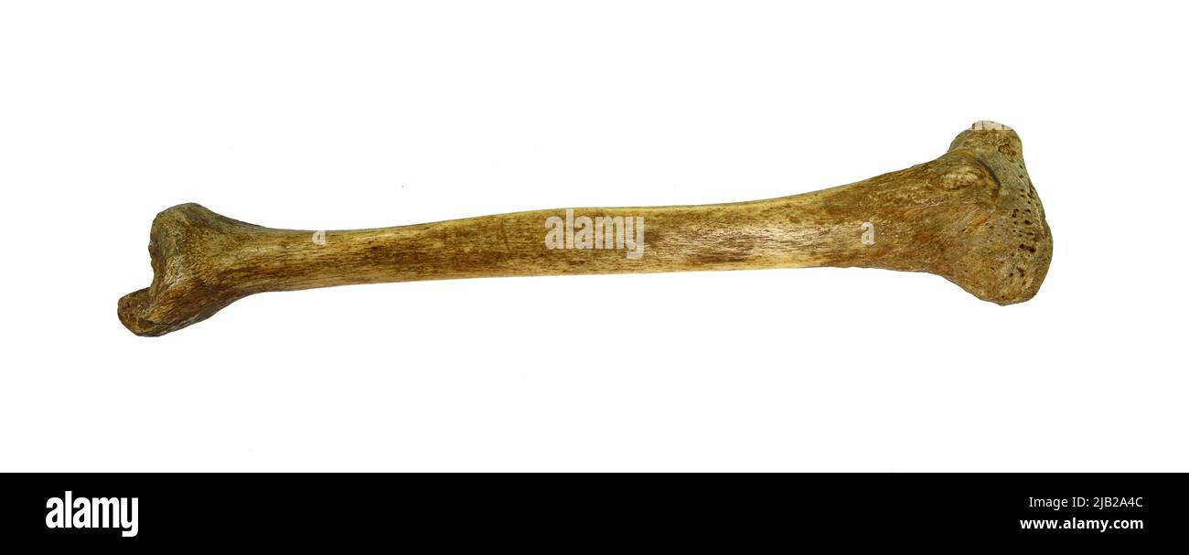 Osso humero di umano isolato su sfondo bianco Foto Stock