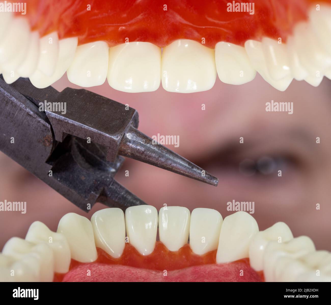 Un uomo vuole strappare un dente con le pinze, vista dalla bocca del paziente, primo piano. Foto Stock