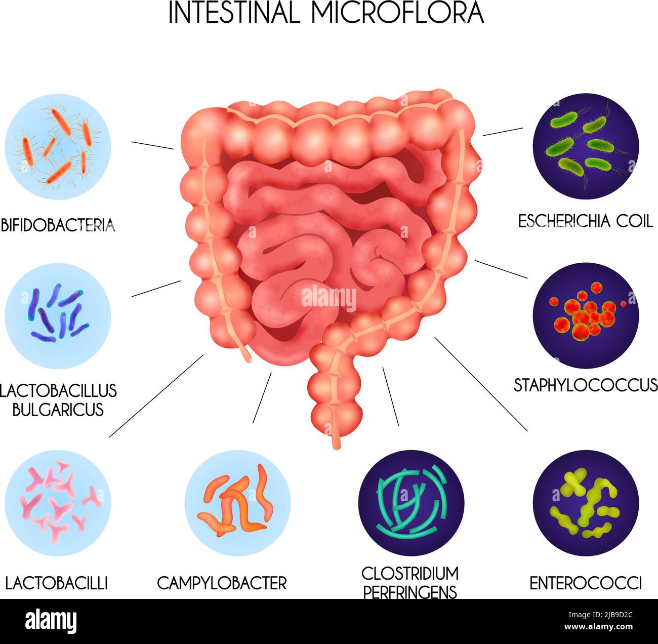 Infografica realistica degli organi interni umani della microflora intestinale dei batteri con la spirale di Escherichia staphylococcus enterococchi clostridium perfringens la Illustrazione Vettoriale