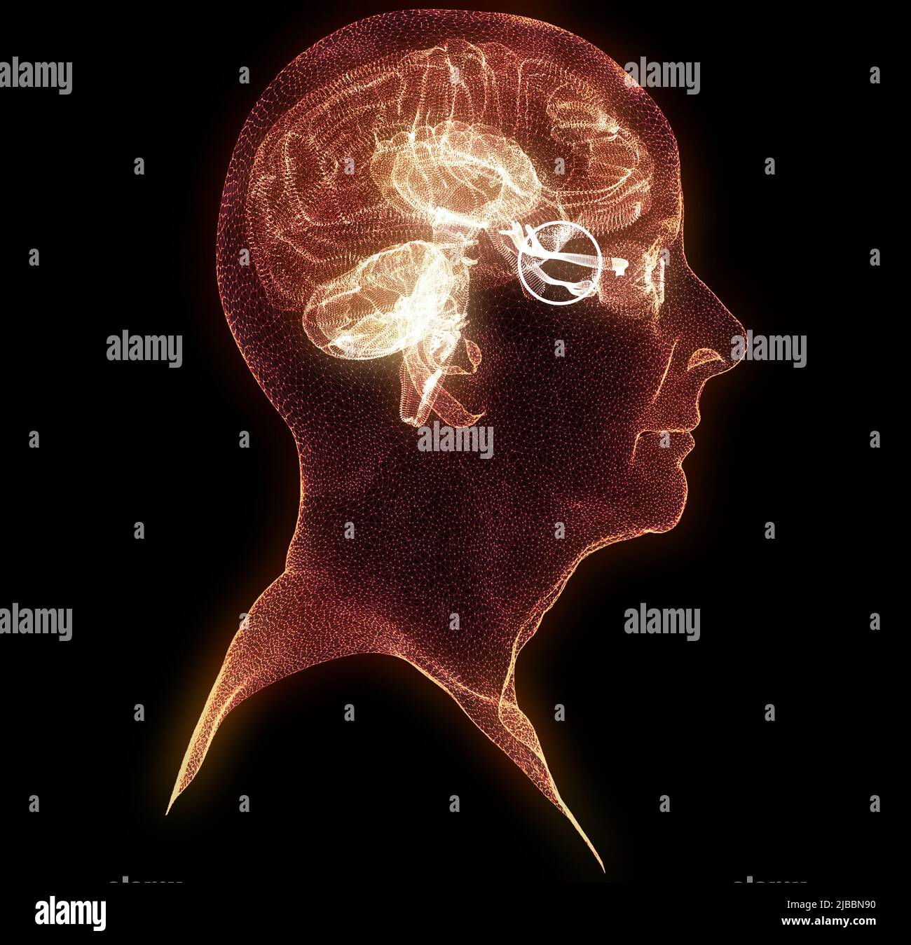 Nervo ottico, sezione del cervello vista dal lato. Lesione nervosa. Scarsa vista. Neurite ottica. Infiammazione, perdita parziale o totale della vista Foto Stock