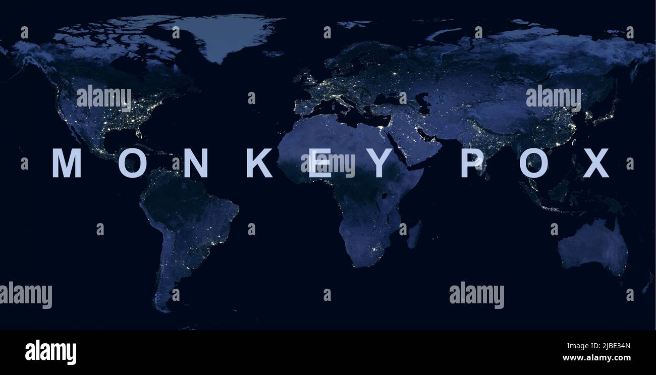 Monkey pox si diffonde in World, parola Monkepox sulla mappa globale notturna. L’economia globale colpisce il virus del vaiolo. Concetto di scimmietta, crisi, viaggi e resric Foto Stock