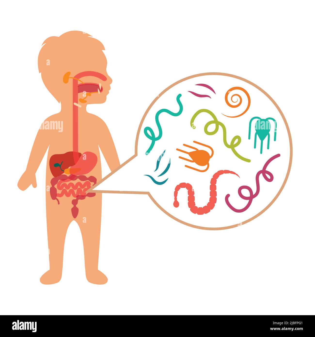 Illustrazione vettoriale di un bambino parassiti intestinali, malattia del verme Illustrazione Vettoriale