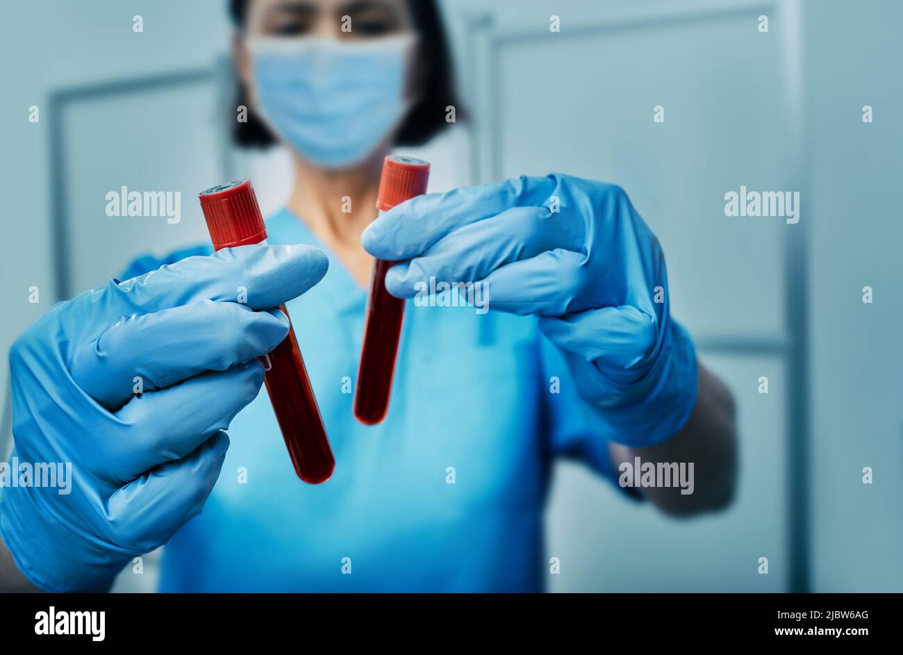 Provette per campioni di sangue con virus Monkeypox infetto da sangue in mani di un assistente di laboratorio, primo piano Foto Stock