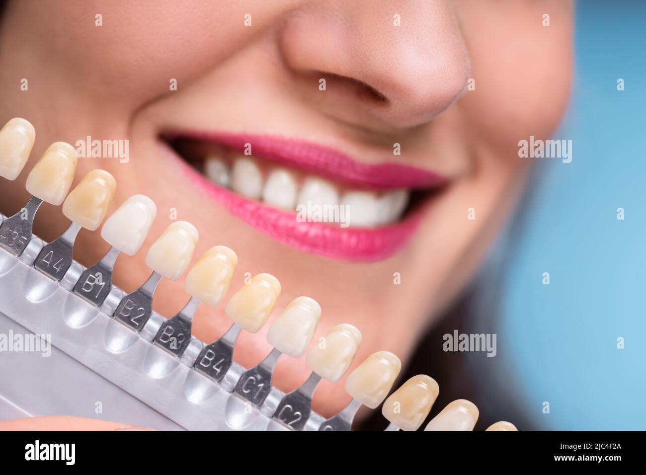 Close-up di una donna felice ombra di adattamento dell'impianto denti Foto Stock