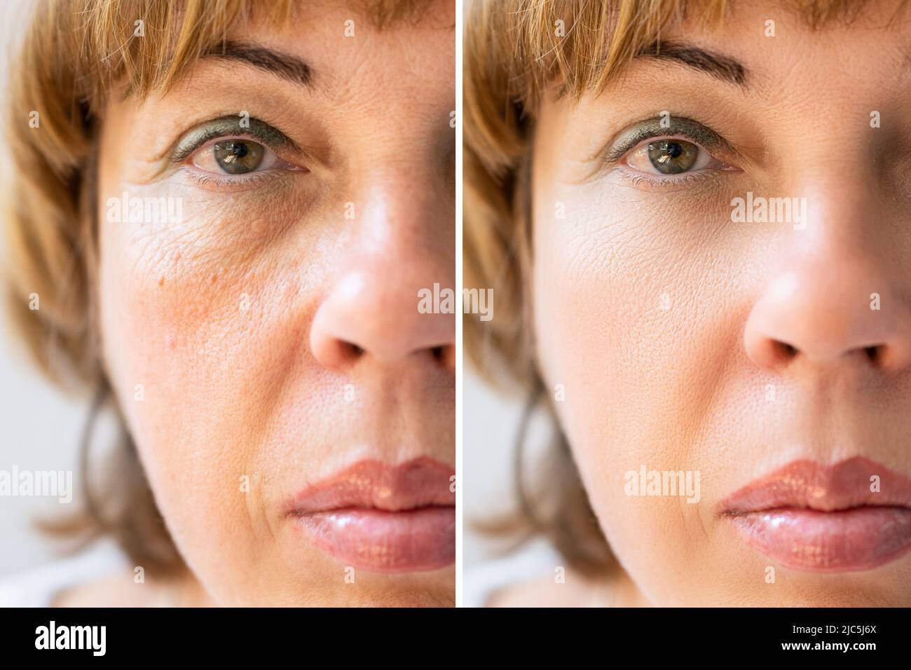 Foto di anti-invecchiamento le procedure sul Caucaso faccia donna Foto Stock