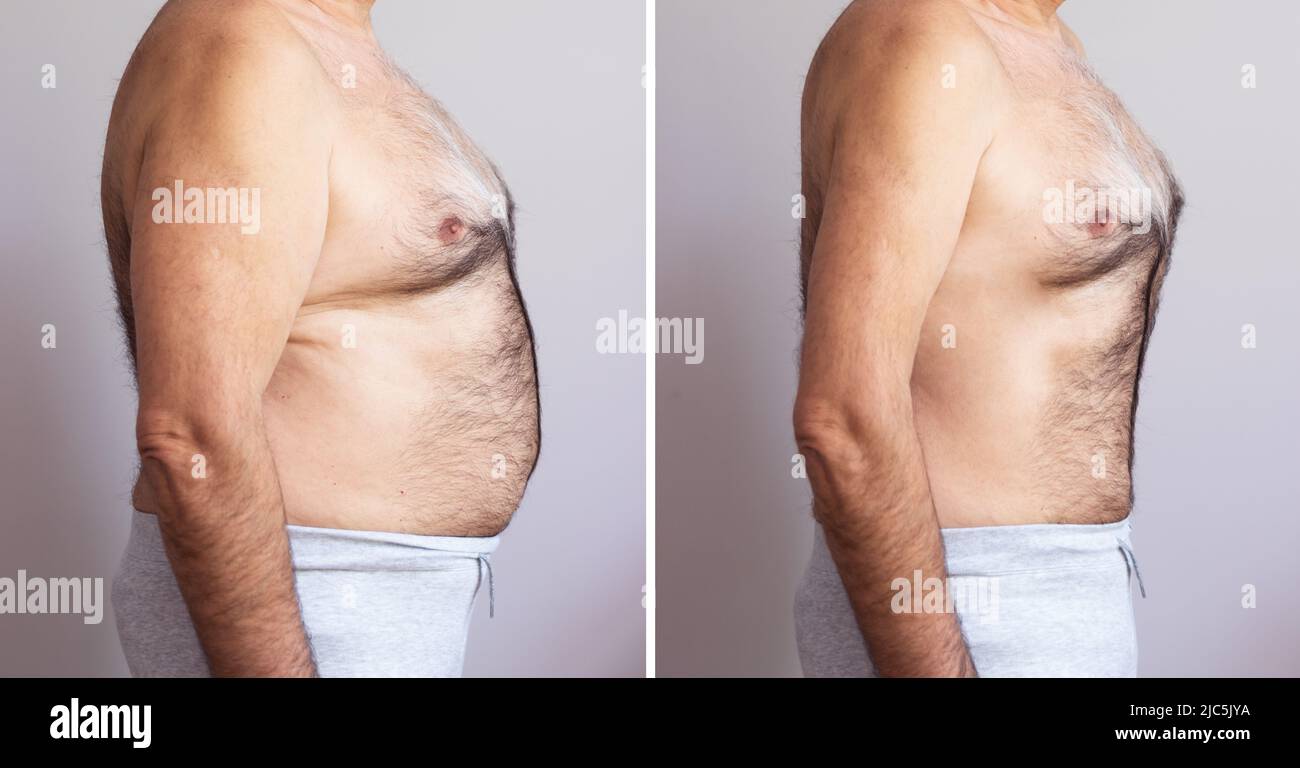 Ritratto di un uomo maturo prima e dopo la perdita di peso su sfondo bianco. Forma del corpo è stata alterata durante il ritocco Foto Stock