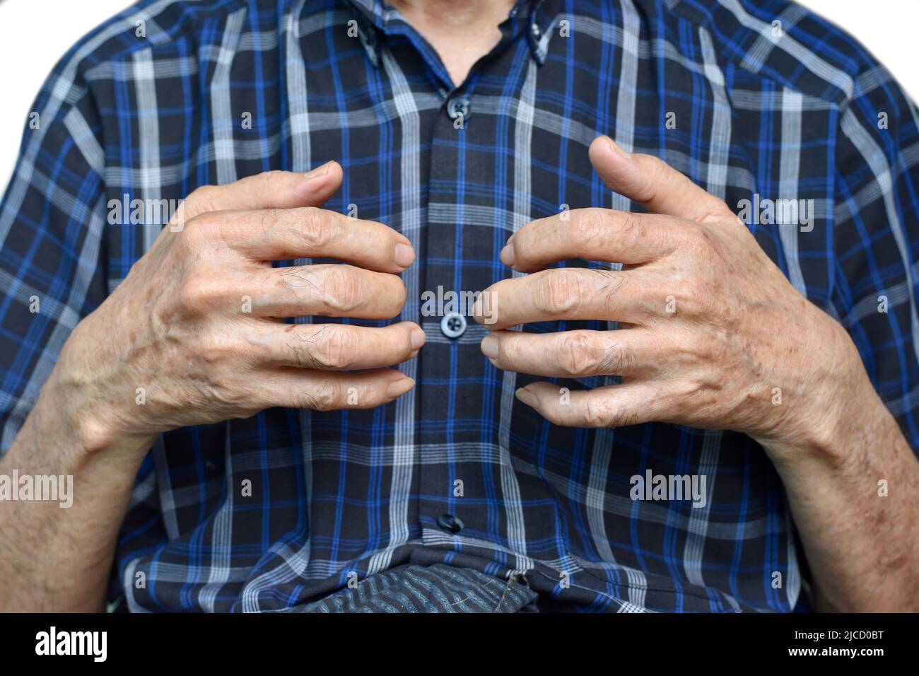 Mano dell'anziano del sud-est asiatico. Concetto di artrite reumatoide, osteoartrite, o dolore articolare. Foto Stock