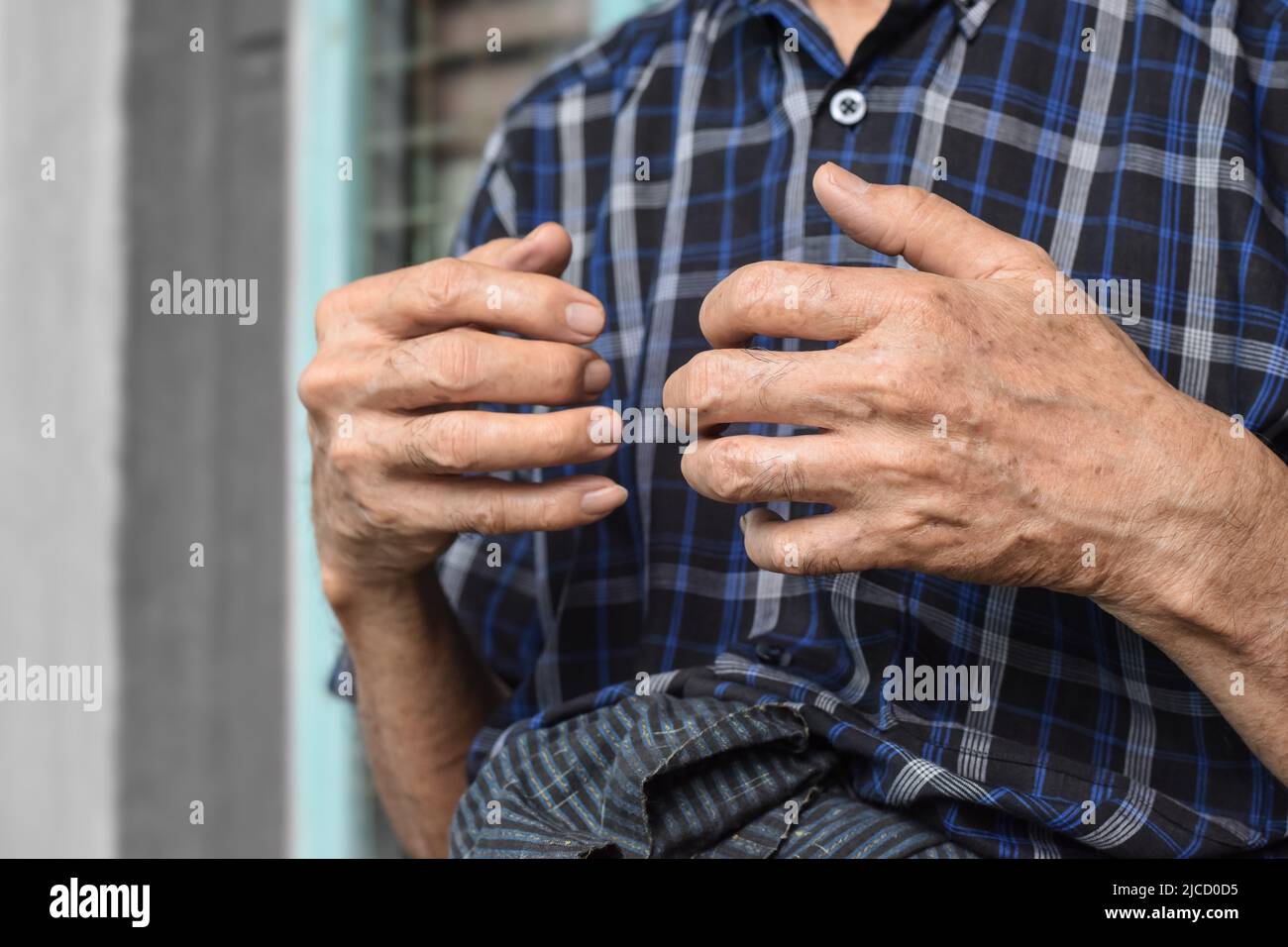 Mano dell'anziano del sud-est asiatico. Concetto di artrite reumatoide, osteoartrite, o dolore articolare. Foto Stock