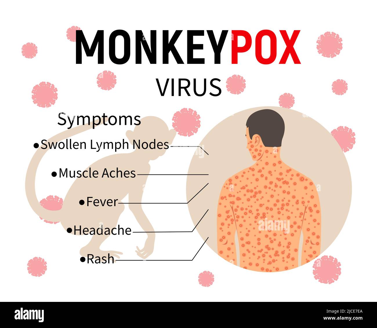 Infografica sui sintomi di Monkeypox. Banner con testo, silhouette di scimmia e corpo umano con eruzione cutanea. Sintomi della malattia - linfonodi gonfi Illustrazione Vettoriale