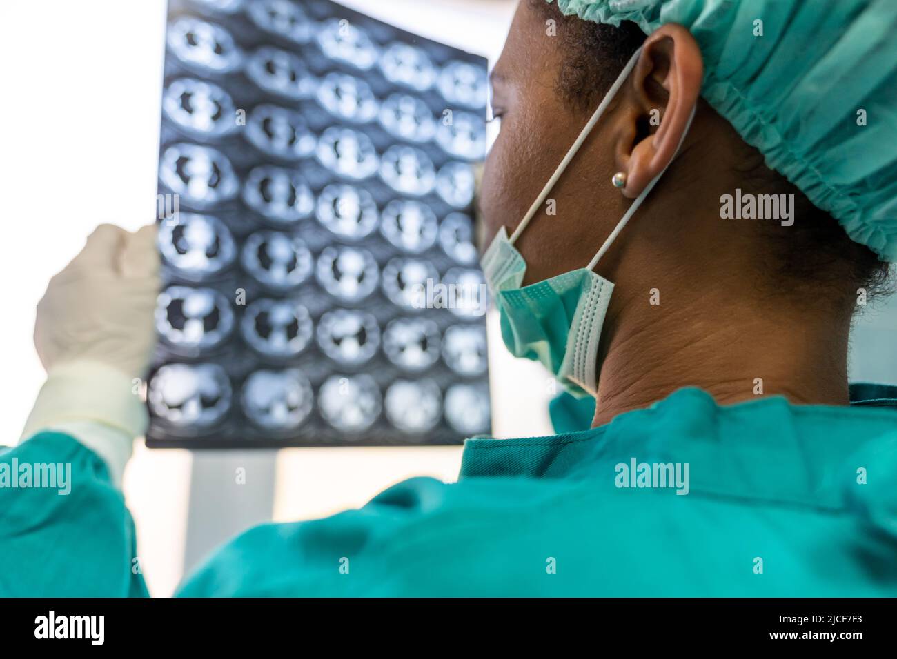 Medico femminile che guarda i raggi X in un ospedale. Concetto di diagnosi di chirurgia sanitaria Foto Stock