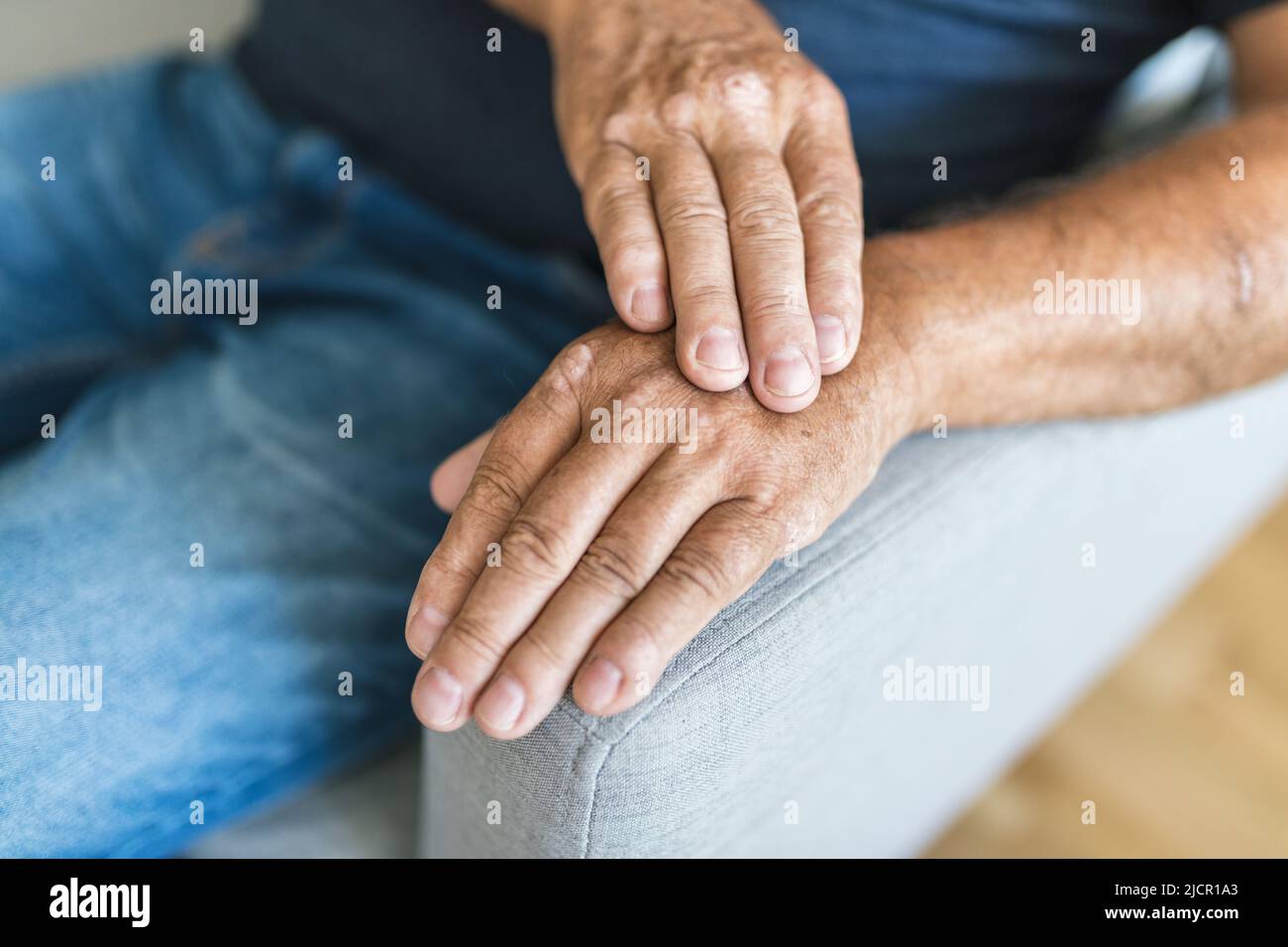 Uomo anziano affetto da psoriasi, primo piano sulle mani Foto Stock