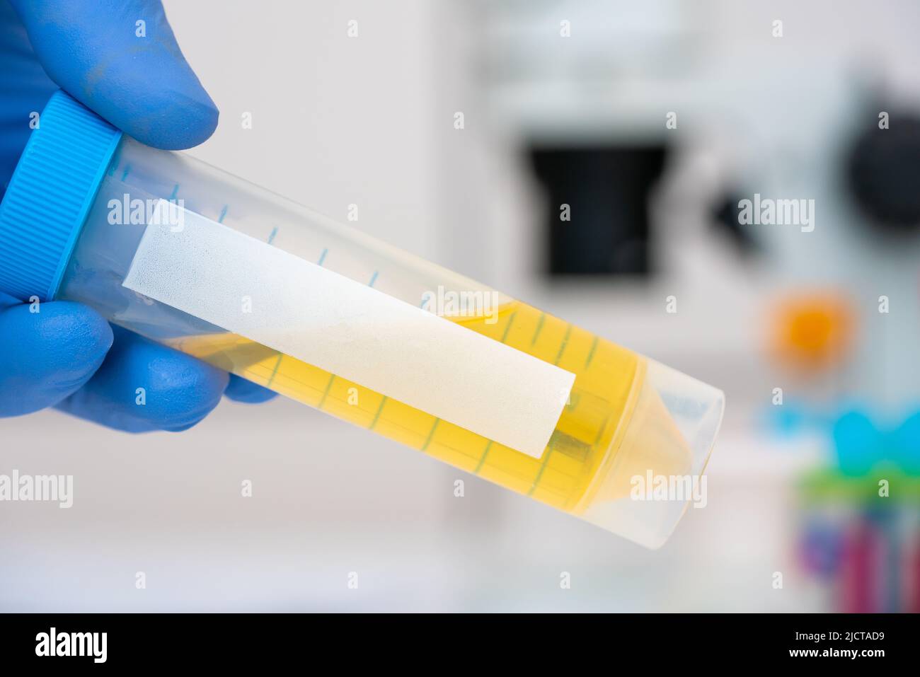 contenitore con un campione di urina per analisi microbiologiche di laboratorio a disposizione degli assistenti di laboratorio Foto Stock