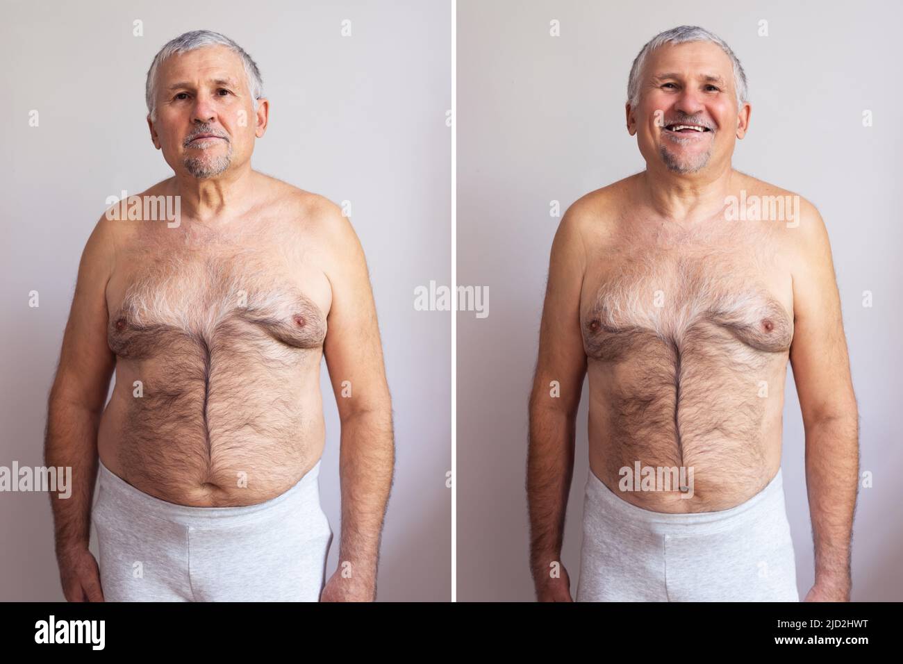 Ritratto di un uomo maturo prima e dopo la perdita di peso su sfondo bianco. Forma del corpo è stata alterata durante il ritocco Foto Stock