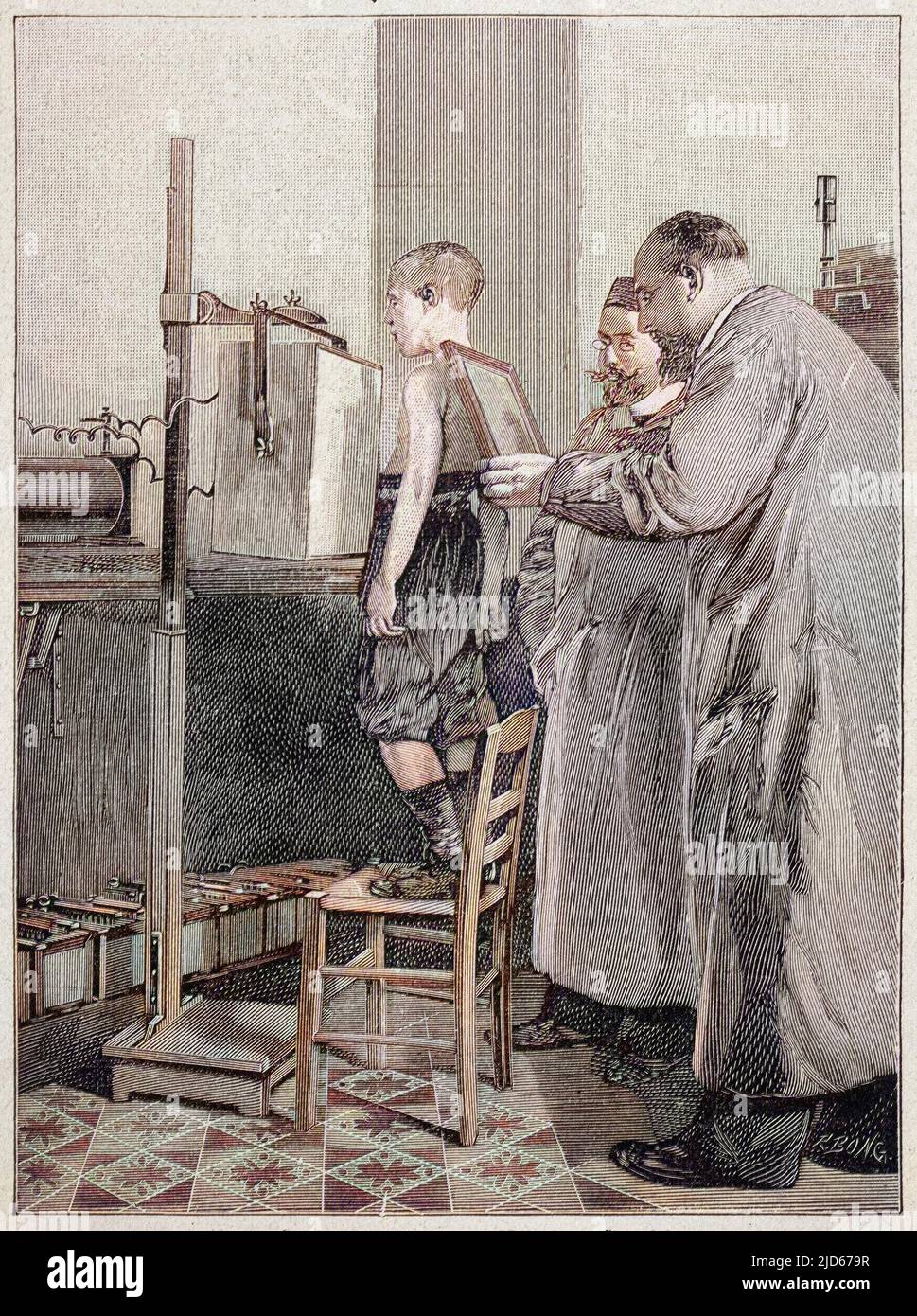 William Konrad Roentgen esamina un paziente. Gli è stato assegnato il Premio Nobel per la fisica 1901 per la sua scoperta nel 1895 di ciò che doveva diventare noto come la radiografia. Versione colorata di : 10015067 Data: 1896 Foto Stock