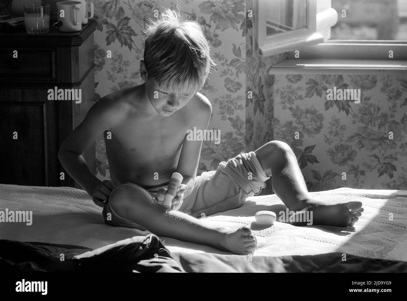 Bambino piccolo che cura il morso di insetti mentre siede sul letto dell'hotel in Francia 1989 trattamenti Foto Stock