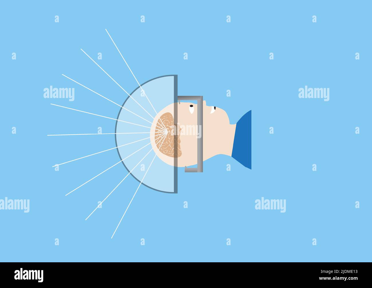 Illustrazione dell'ecografia a fuoco guidato con risonanza magnetica (MRgFUS) per il trattamento del tremore essenziale e del disturbo neurologico. Illustrazione Vettoriale