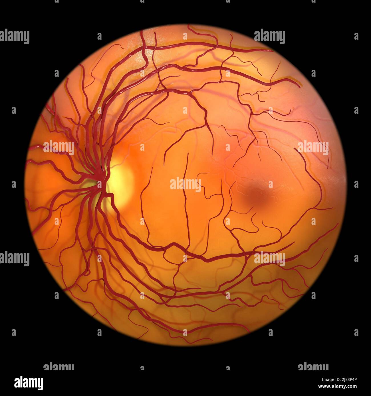 Retina normale, immagine oftalmoscopica, illustrazione. La retina è la membrana sensibile alla luce che allinea la parte posteriore dell'occhio. I vasi sanguigni (rossi) irradiano dal disco ottico (giallo, sinistro). Il disco ottico è l'area in cui il nervo ottico e i vasi sanguigni entrano nell'occhio. Per questo motivo, non ha celle fotosensibili ed è la causa del punto cieco. L'area rossa scura al centro a destra è la macula. Questa è la regione della retina con la più alta concentrazione di cellule sensibili alla luce, ed è responsabile della visione nitida al centro del campo visivo. Foto Stock