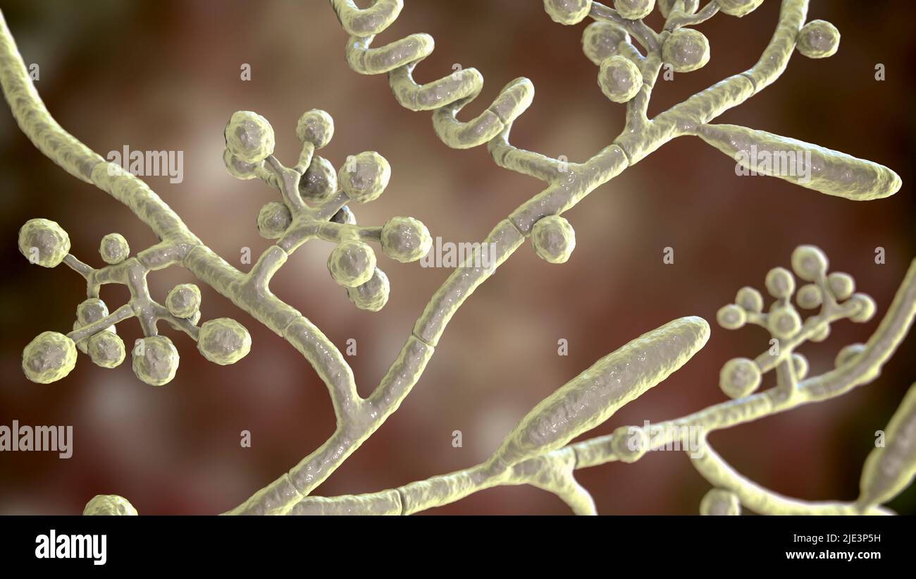 Funghi Trichophyton mentagrophytes, la causa del piede dell'atleta (tinea pedis), il ringworm del cuoio capelluto (tinea capitus), e l'infezione del chiodo (onicomicosi), illu Foto Stock