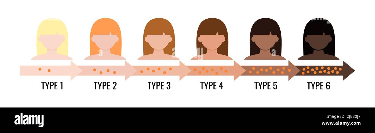 Fitzpatrick skin tone fototipo melanina indice grafico con avatar femminile  Immagine e Vettoriale - Alamy