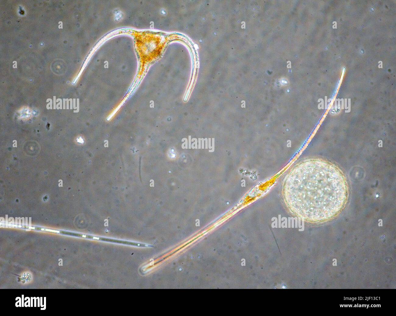 4 diverse alghe planctoniche: Halosphaera sp. (A forma di sfera), diatomo (Rhizosolenia sp.) E dinoflagellati (Ceratium horridum e C. fusus). Foto Stock