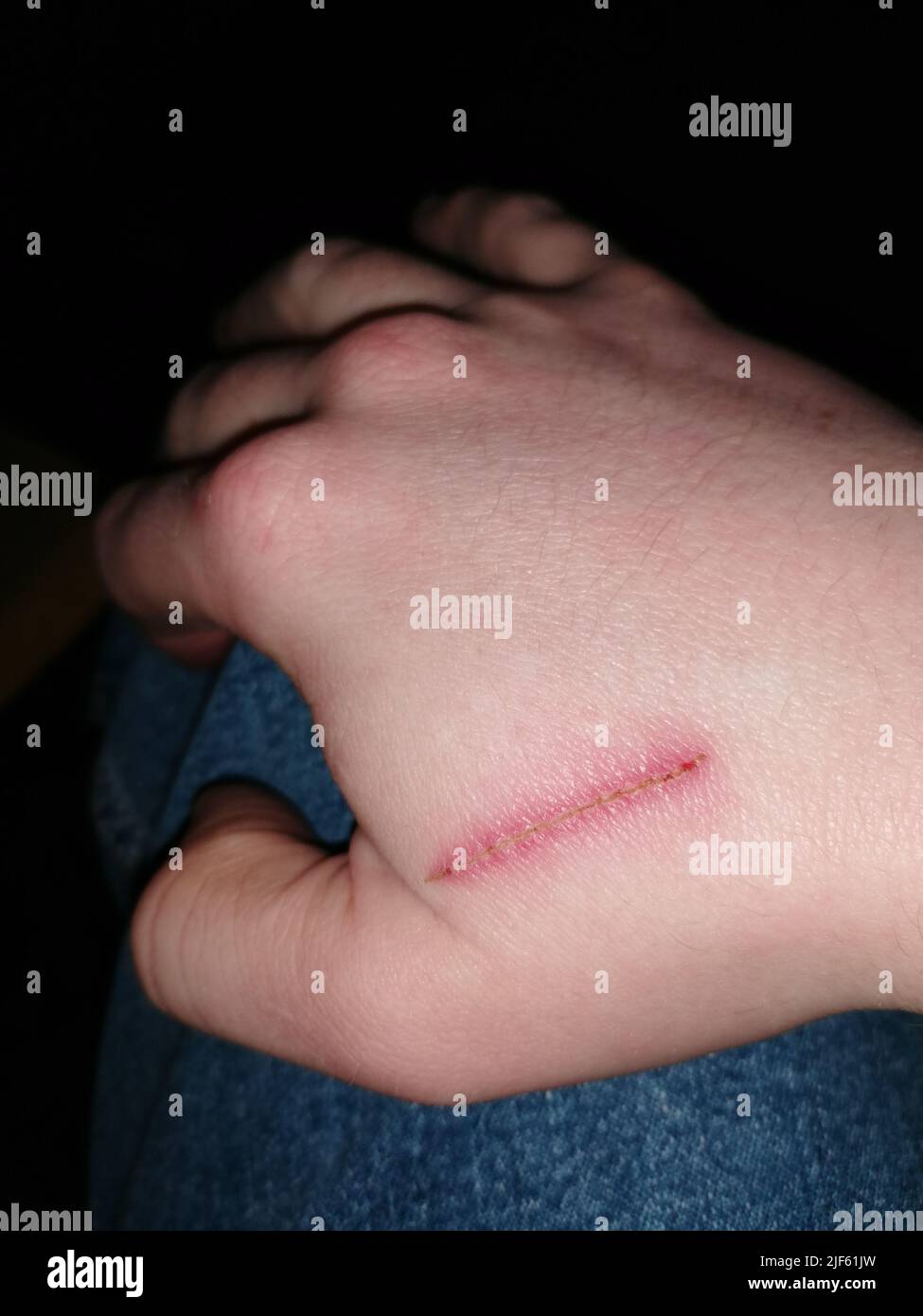 Schnitt in mano, Verletzung Foto Stock