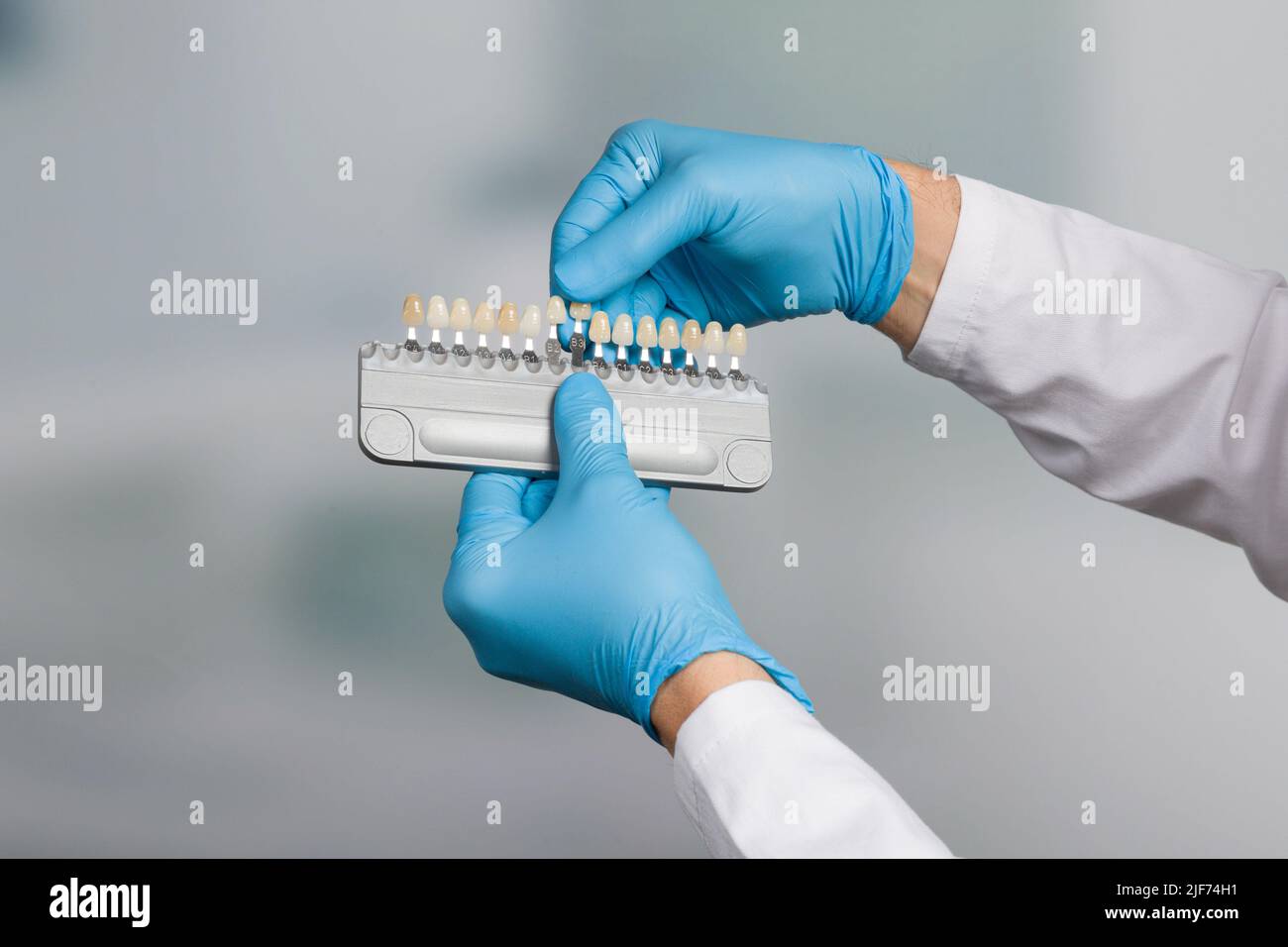 La mano del dentista con guida dell'ombra per controllare/determinare l'impiallacciatura dei denti in un odontoiatria Foto Stock