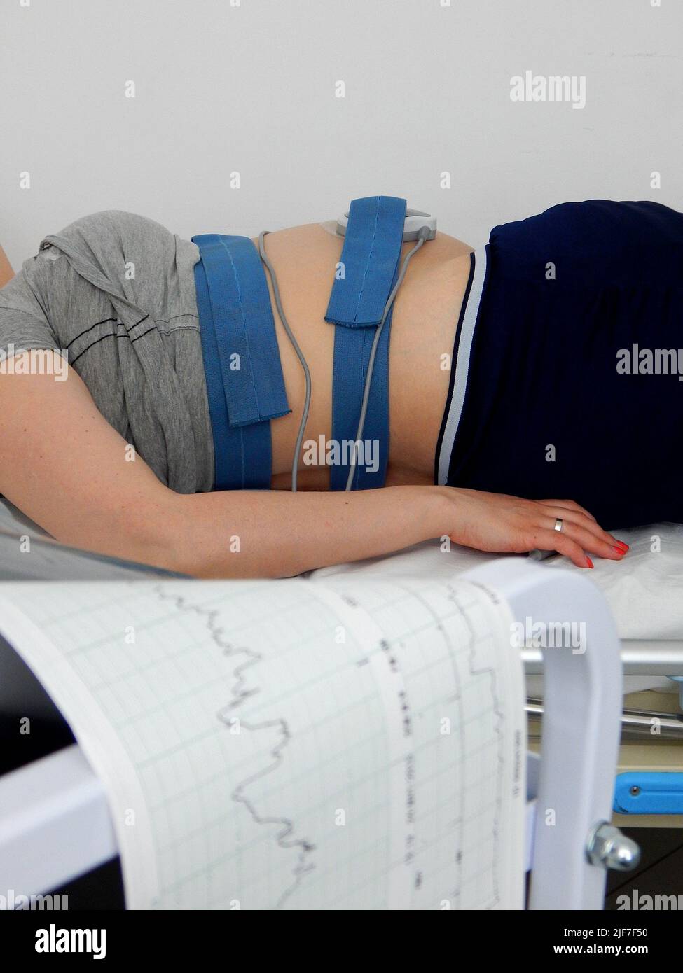 Donna incinta che riposa mentre l'elettrocardiografo stampa la frequenza cardiaca fetale Foto Stock