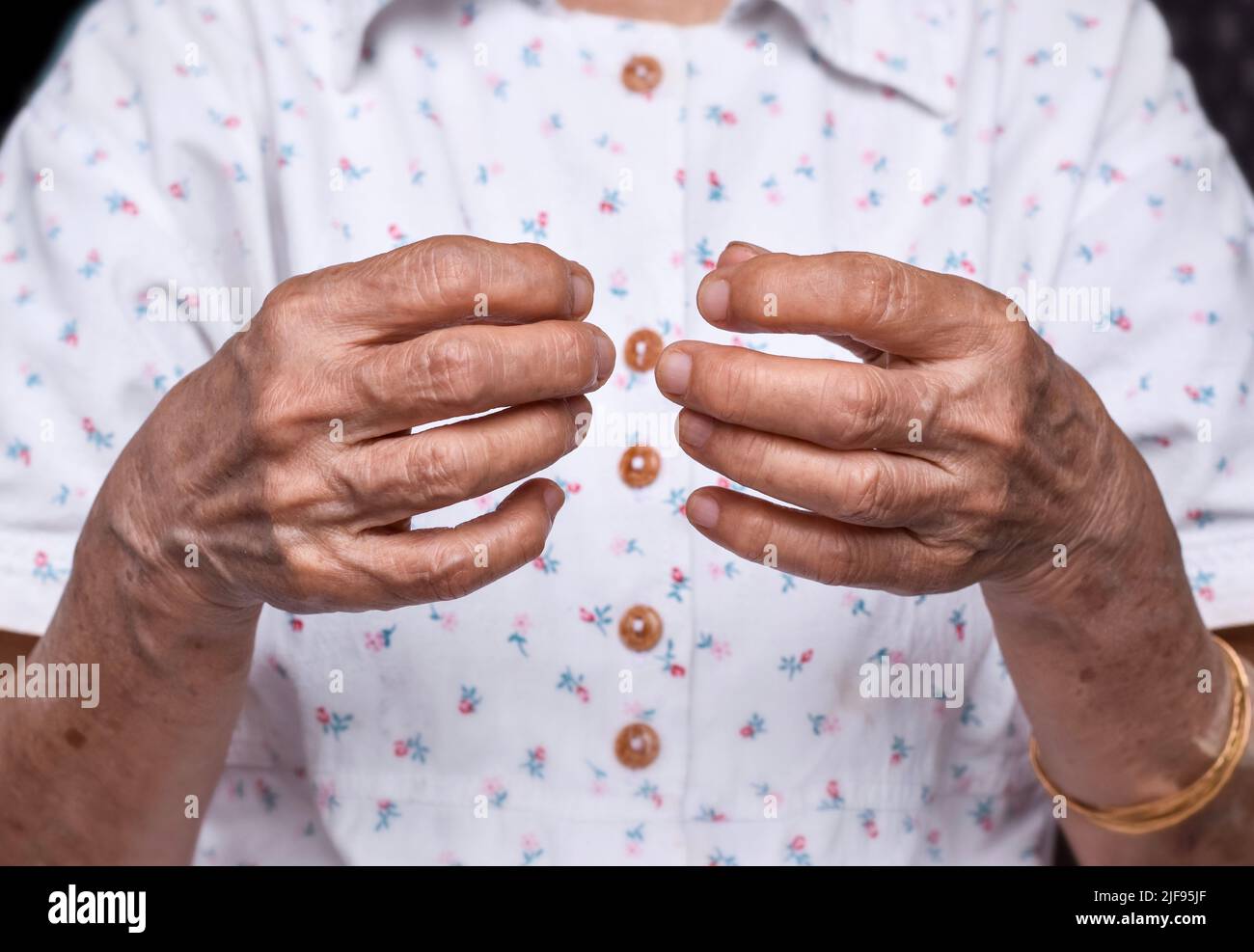 Mani della donna anziana del sud-est asiatico. Concetto di artrite reumatoide, osteoartrite, o dolore articolare. Debolezza della mano. Foto Stock