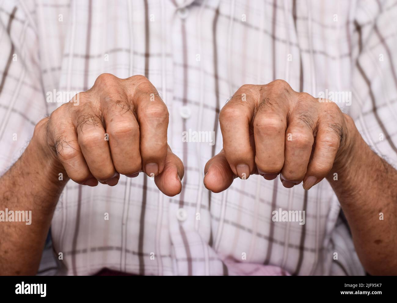 Mani dell'anziano del sud-est asiatico. Concetto di artrite reumatoide, osteoartrite, o dolore articolare. Debolezza della mano. Foto Stock