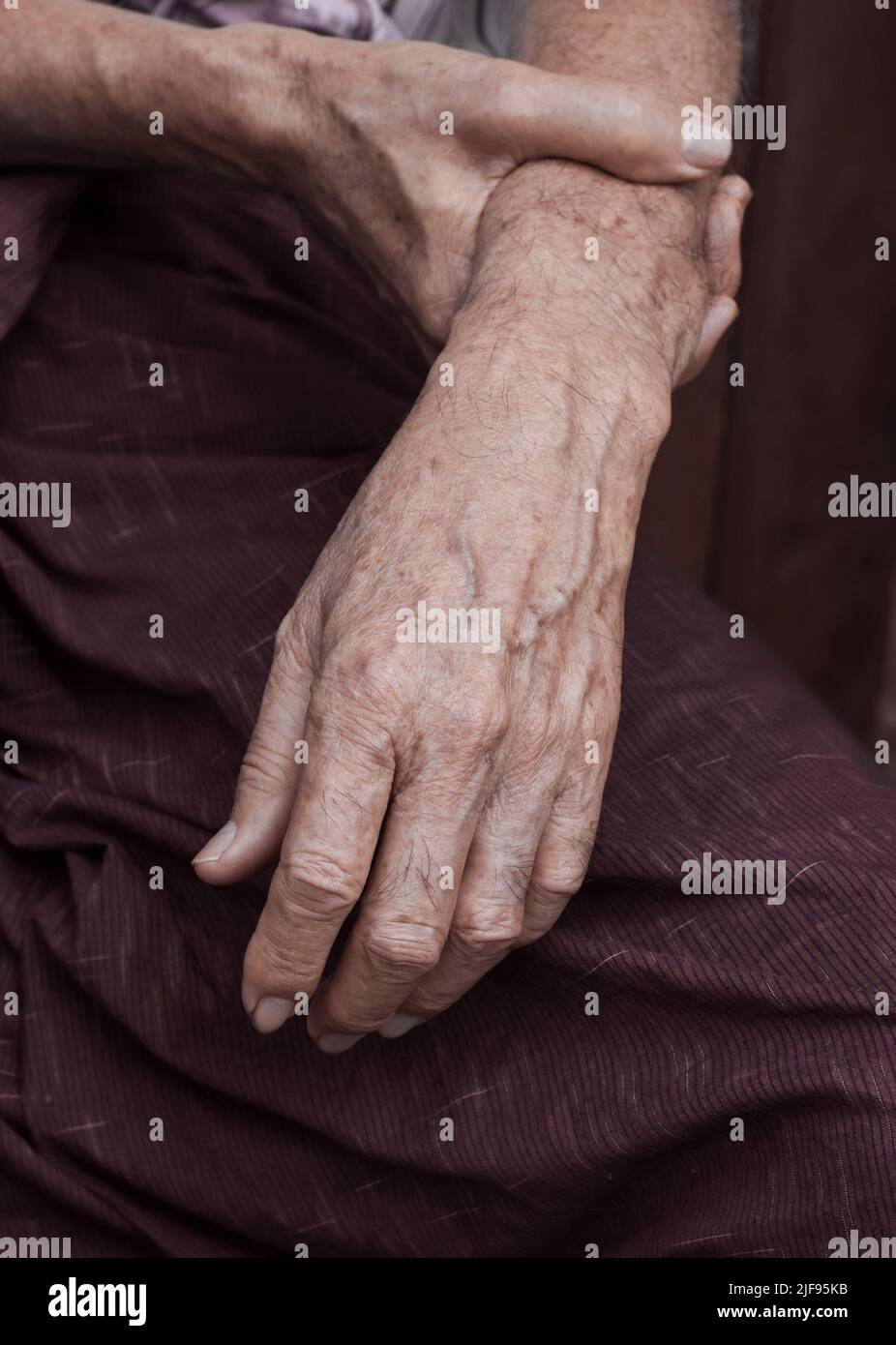 Mano dell'anziano del sud-est asiatico. Concetto di artrite reumatoide, osteoartrite, o dolore articolare. Foto Stock