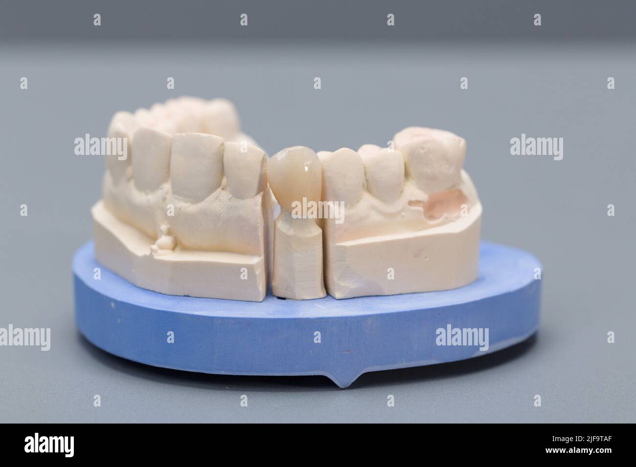 primo piano della denizione artiale pronta per l'uso sul banco da lavoro da laboratorio odontoiatrico Foto Stock