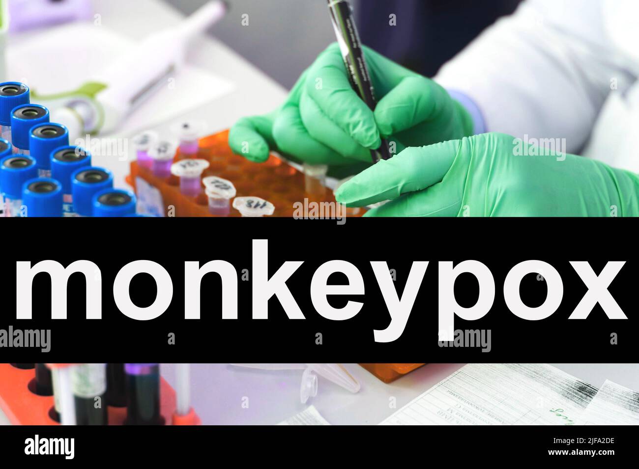 Analisi delle provette Monkeypox in laboratorio Foto Stock