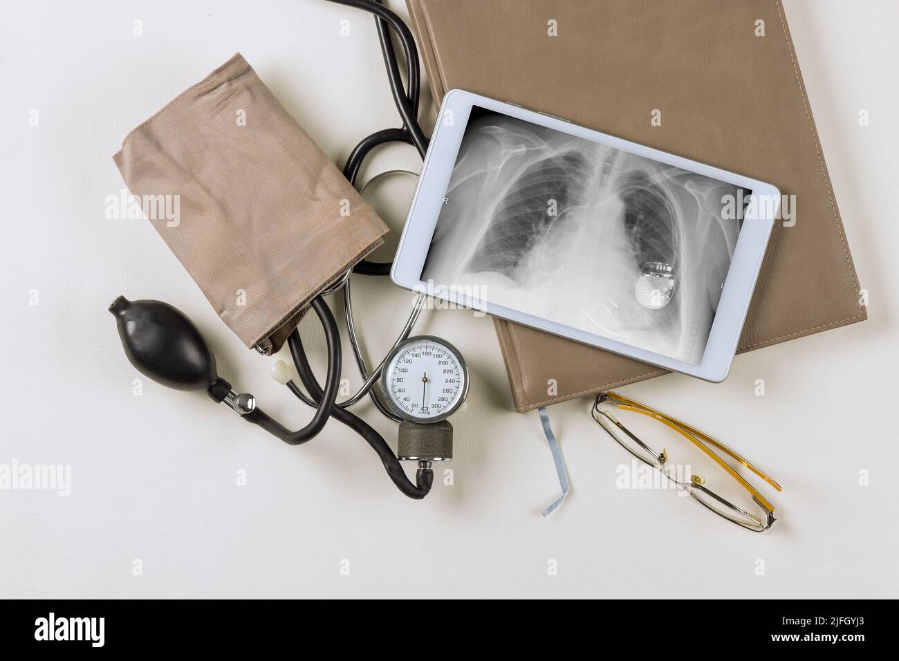 Una radiografia del monitor in un ufficio medico indica che il pacemaker è stato installato correttamente Foto Stock