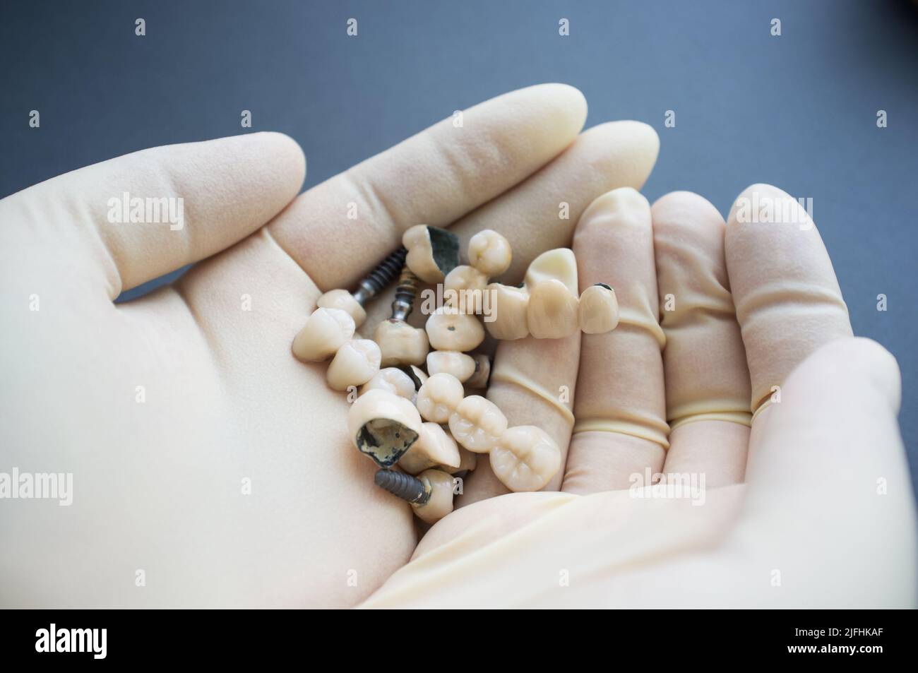 Palme dentiste con dentici e corone diverse Foto Stock
