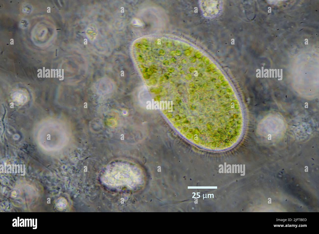 Parmecium bursaria con alghe verdi endosimbiotiche (Zooclorella sp.) da una coltura di acqua dolce. Foto Stock