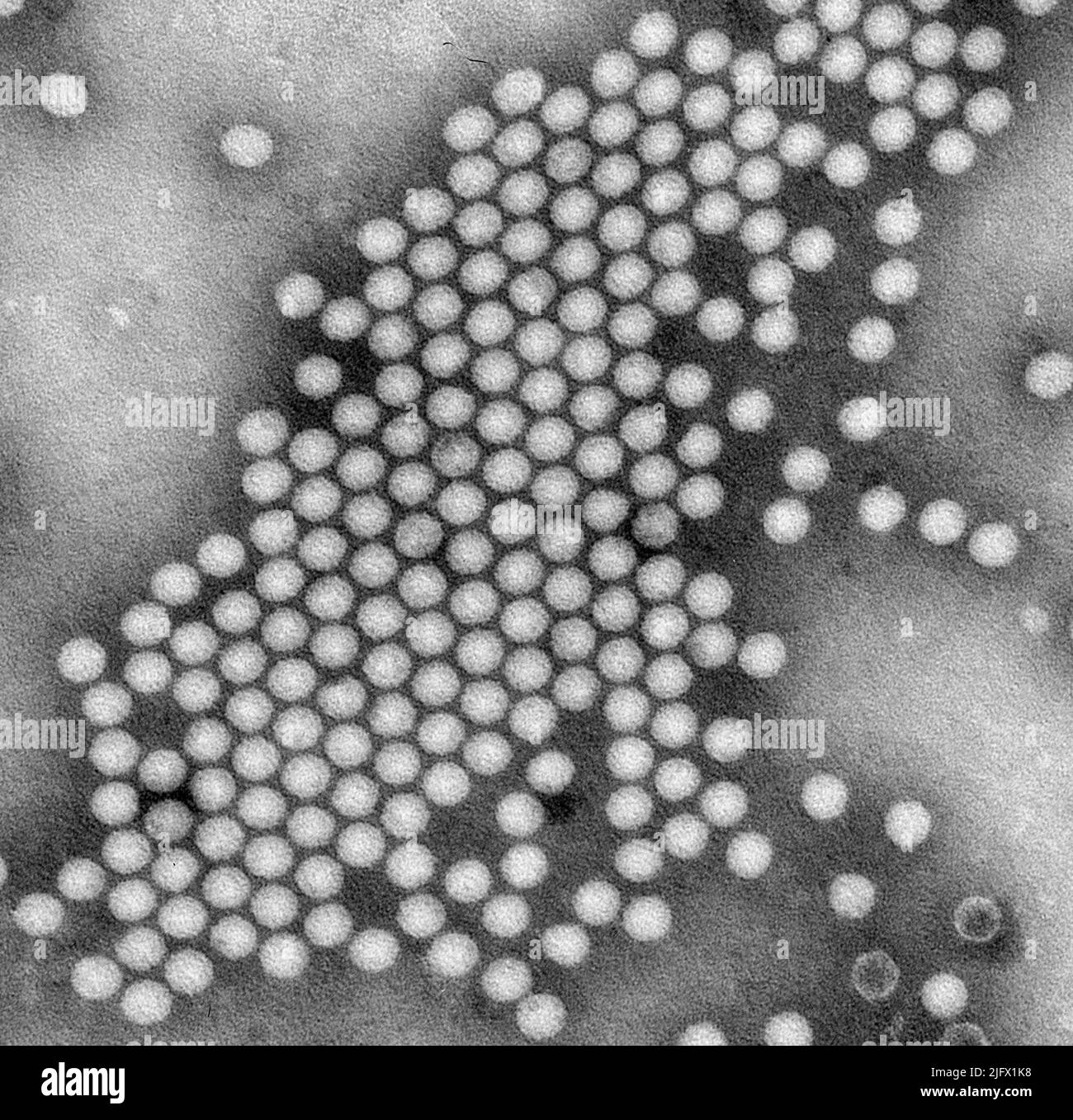 Questo microscopio elettronico a trasmissione (TEM), immagine di colorazione negativa, rivela alcune delle caratteristiche ultrostrutturali esibite da un raggruppamento di particelle di virus della poliomielite a forma di icosaedro. Una versione ottimizzata e migliorata di un'immagine prodotta dai Centri statunitensi per il controllo e la prevenzione delle malattie / credito CDC / J.J..Esposito; F.A.Murphy Foto Stock