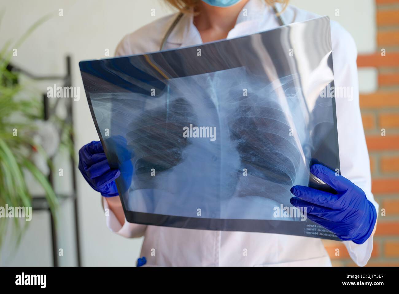 Medico che tiene in mano la fotografia radiografica dei polmoni Foto Stock